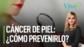 Cáncer de piel: ¿cómo prevenirlo? | Vive Más