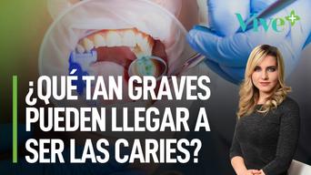 ¿Qué tan graves pueden llegar a ser las caries? | Vive Más