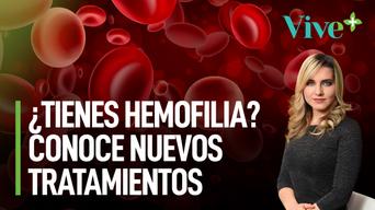 ¿Tienes hemofilia? Conoce nuevos tratamientos en pandemia | Vive Más