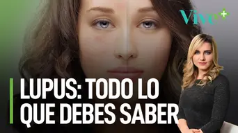 Una vida con lupus: Todo lo que debes saber | Vive Más Una vida con lupus: Todo lo que debes saber | Vive Más